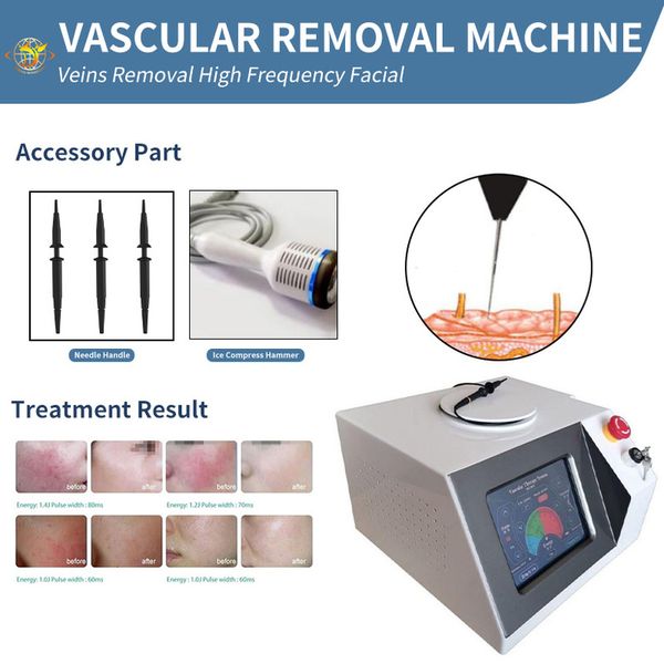 waist & tummy shaper the rf high frequency vascular removal machine blood vessel spider vein removals
waist & tummy shaper the rf high frequency vascular removal machine blood vessel spider vein removals