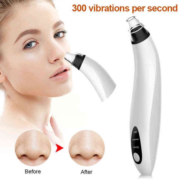 face care devices blackhead remover electric acne cleaner point vacuum tool spots pore machine 2022 new 220211
face care devices blackhead remover electric acne cleaner point vacuum tool spots pore machine 2022 new 220211