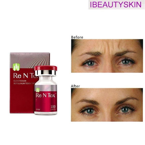 beauty items saline innotox botulax 100u 150u 200u 50iu btx toxins nabota hutoxs rentox meditoxins botulinicas
beauty items saline innotox botulax 100u 150u 200u 50iu btx toxins nabota hutoxs rentox meditoxins botulinicas