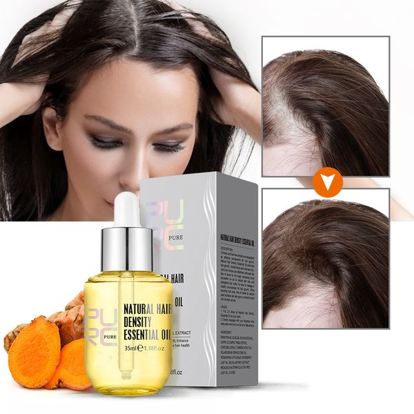 purc ginger essence hair growth products fast regrowth oil serum hair loss enhancer care beauty scalp treatment 35ml
purc ginger essence hair growth products fast regrowth oil serum hair loss enhancer care beauty scalp treatment 35ml