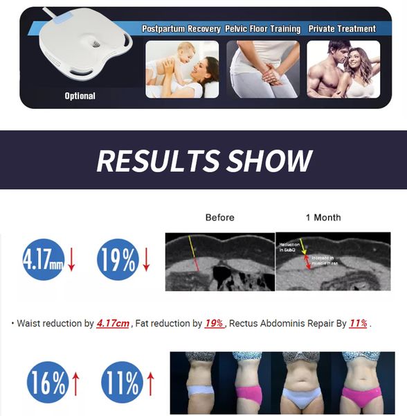 emslim handler muscletech rf em slim emshape shock wave slimming muscle machine re new body stimulate electrical stimulator for sale price
emslim handler muscletech rf em slim emshape shock wave slimming muscle machine re new body stimulate electrical stimulator for sale price