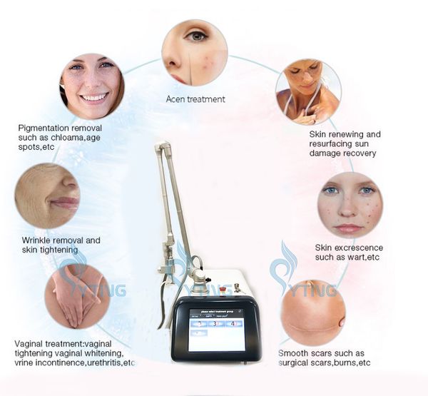 co2 fractional laser machine skin renewing wrinkle scar removal acne teatment device, Black
co2 fractional laser machine skin renewing wrinkle scar removal acne teatment device, Black