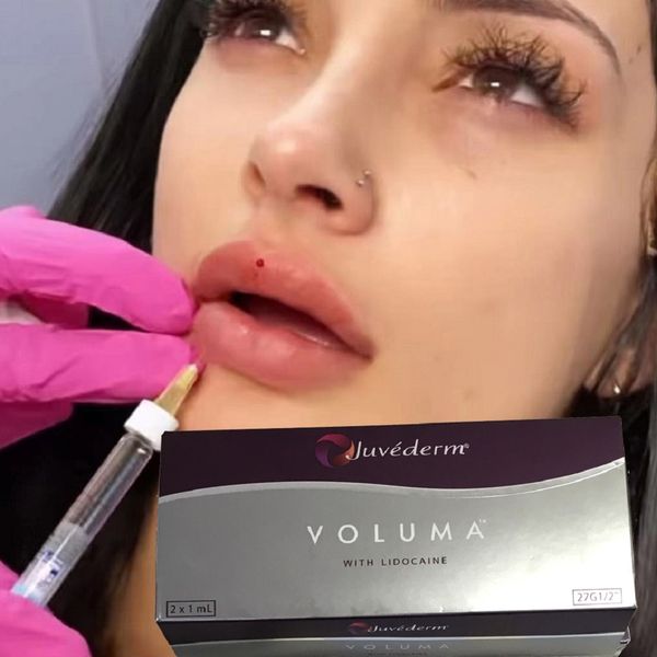 beauty items juvaderm voluma injectable dermal filler hyaluronics acids cross linked reshape facial contour
beauty items juvaderm voluma injectable dermal filler hyaluronics acids cross linked reshape facial contour