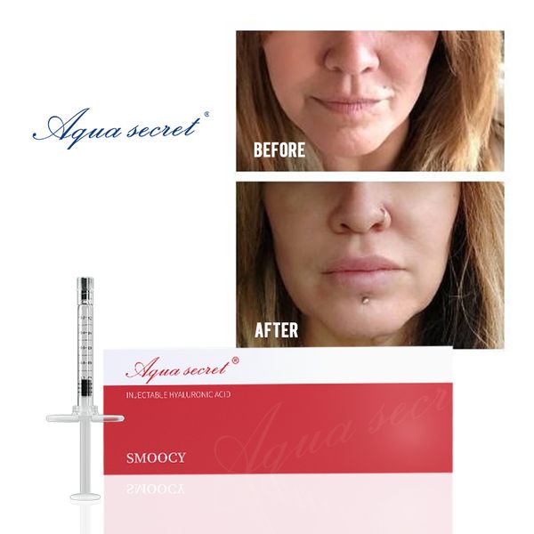 beauty items aqua secret dermal filler injection collagen filler for face with micro cannula
beauty items aqua secret dermal filler injection collagen filler for face with micro cannula