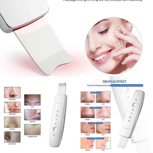 nxy face care devices ultrasonic face scrubber beauty red&blue light led pn therapy ems facial peeling ion pore clean remove blackhead exfol
nxy face care devices ultrasonic face scrubber beauty red&blue light led pn therapy ems facial peeling ion pore clean remove blackhead exfol