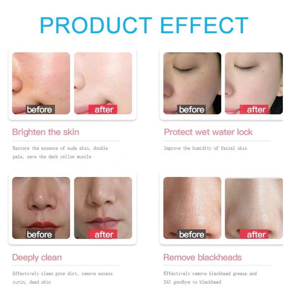 Â as1 sa2 ao3 concentrate aqua peeling solution 50ml hydra dermabrasion face clean blackhead export liquid for beauty salon skin perfections
 as1 sa2 ao3 concentrate aqua peeling solution 50ml hydra dermabrasion face clean blackhead export liquid for beauty salon skin perfections