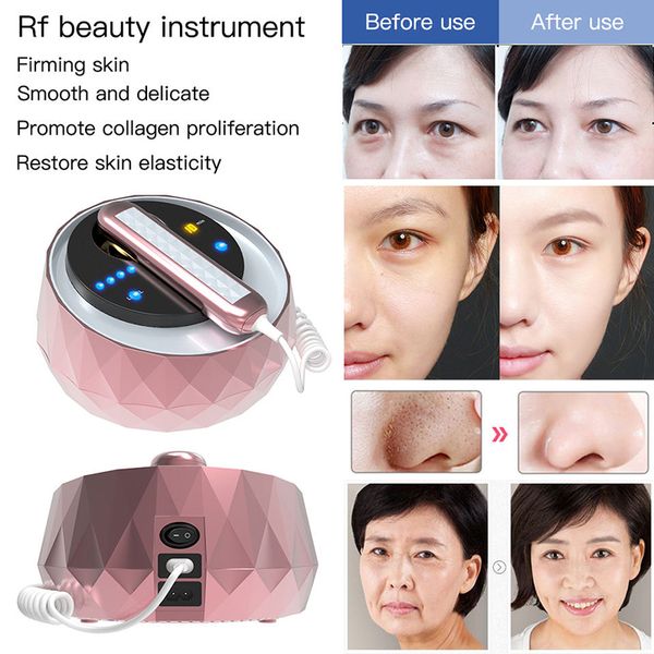 3 in 1 facial mesotherapy rf radio frequency face lifting tightening wrinkle removal skin care face massager body shaping firming sculpting
3 in 1 facial mesotherapy rf radio frequency face lifting tightening wrinkle removal skin care face massager body shaping firming sculpting