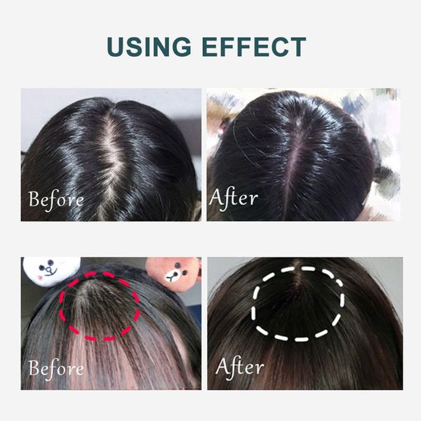 electric laser comb scalp massage ems ionic infrared hair growth brush light therapy magic hair head vibration massager perfections
electric laser comb scalp massage ems ionic infrared hair growth brush light therapy magic hair head vibration massager perfections