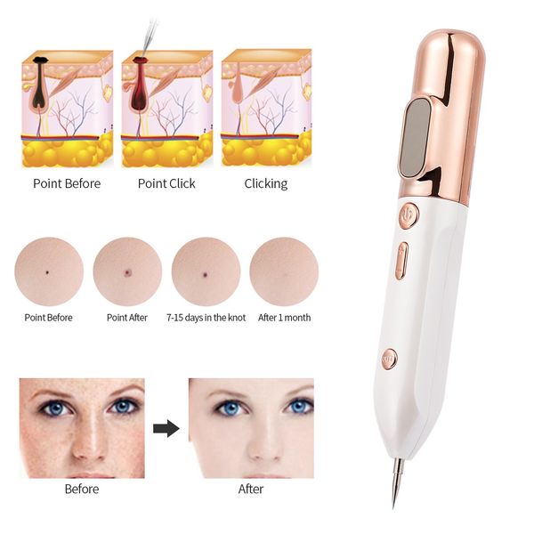 wireless laser plasma pen mole tattoo remover skin pore care corn freckle dark tag nevus pimple spot cleaner beauty machine perf
wireless laser plasma pen mole tattoo remover skin pore care corn freckle dark tag nevus pimple spot cleaner beauty machine perf