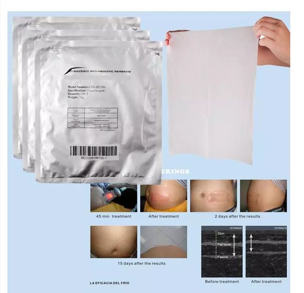 antie membrane accessories & parts cryolipolysis therapy fat ing treatment cryo pad cool tech sculpt cryotherapy anti-ing film weightloss ma
antie membrane accessories & parts cryolipolysis therapy fat ing treatment cryo pad cool tech sculpt cryotherapy anti-ing film weightloss ma