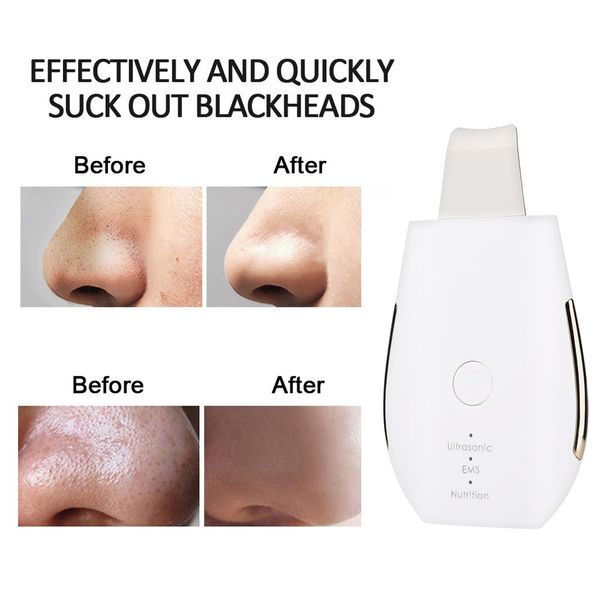 ultrasonic face cleaning skin scrubber vibration facial cleaner skin peeling blackhead removal pore cleaner beauty face lifting
ultrasonic face cleaning skin scrubber vibration facial cleaner skin peeling blackhead removal pore cleaner beauty face lifting