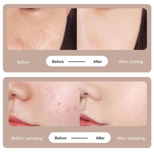 9 level lcd face skin dark spot remover mole laser plasma pen tattoo removal plasma machine facial freckle tag wart removal tool perfections 
9 level lcd face skin dark spot remover mole laser plasma pen tattoo removal plasma machine facial freckle tag wart removal tool perfections