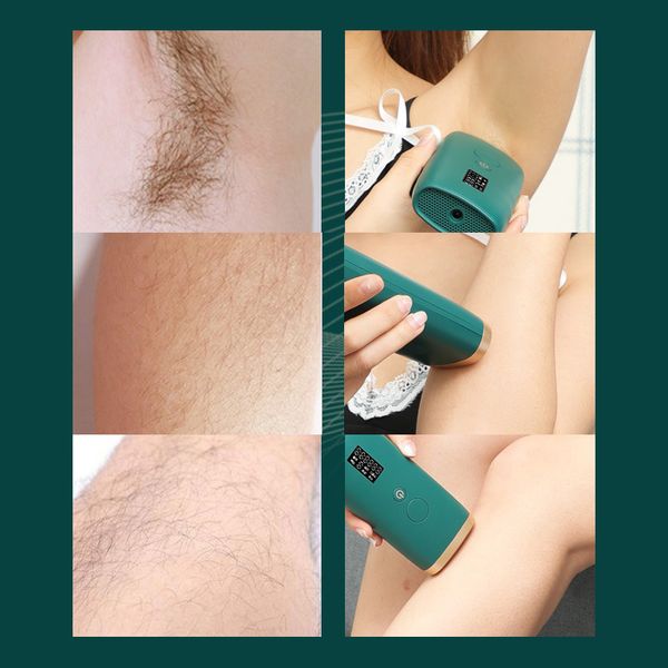 990000 flashes ipl laser hair removal pn permanent 5 levels auto epilator women facial body painless hair trimmer shaver 50
990000 flashes ipl laser hair removal pn permanent 5 levels auto epilator women facial body painless hair trimmer shaver 50