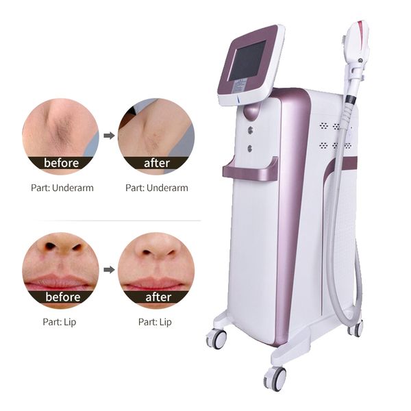 factory price dpl opt ipl hair removal ndyager tattoo remove acne treatment skin care system e-light
factory price dpl opt ipl hair removal ndyager tattoo remove acne treatment skin care system e-light