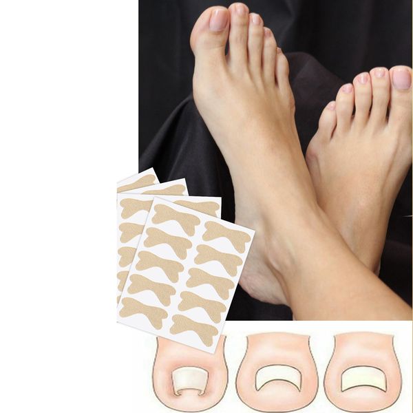 50pcs foot treatment toenail correction sticker nail ingrown onychomycosis padding pads orthodontic stickers toe nails toe clippers package
50pcs foot treatment toenail correction sticker nail ingrown onychomycosis padding pads orthodontic stickers toe nails toe clippers package