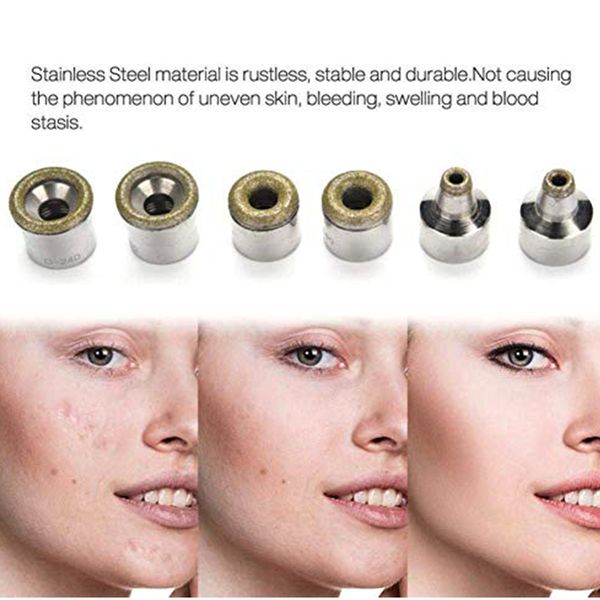 diamond microdermabrasion dermabrasion 3 wands 9 tips for facial peeling blackhead remover face care tool salon beauty machine p
diamond microdermabrasion dermabrasion 3 wands 9 tips for facial peeling blackhead remover face care tool salon beauty machine p