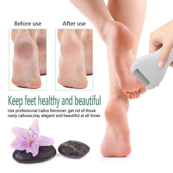 waterproof usb rechargeable electric pedicure tools foot care machine callus remover dead skin remover foot file heel cleaner pe
waterproof usb rechargeable electric pedicure tools foot care machine callus remover dead skin remover foot file heel cleaner pe
