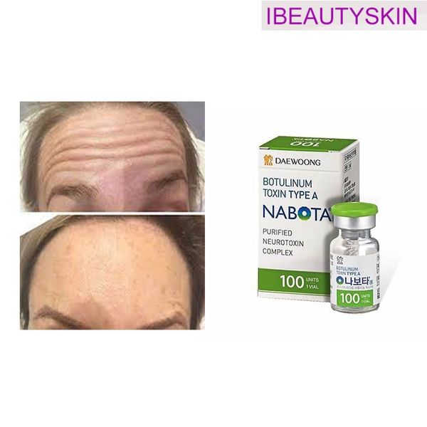 beauty items innotoxs botulaxs 100u 150u 200u type a btx toxins nabotas hutoxs rentoxs meditoxins botulinicas
beauty items innotoxs botulaxs 100u 150u 200u type a btx toxins nabotas hutoxs rentoxs meditoxins botulinicas