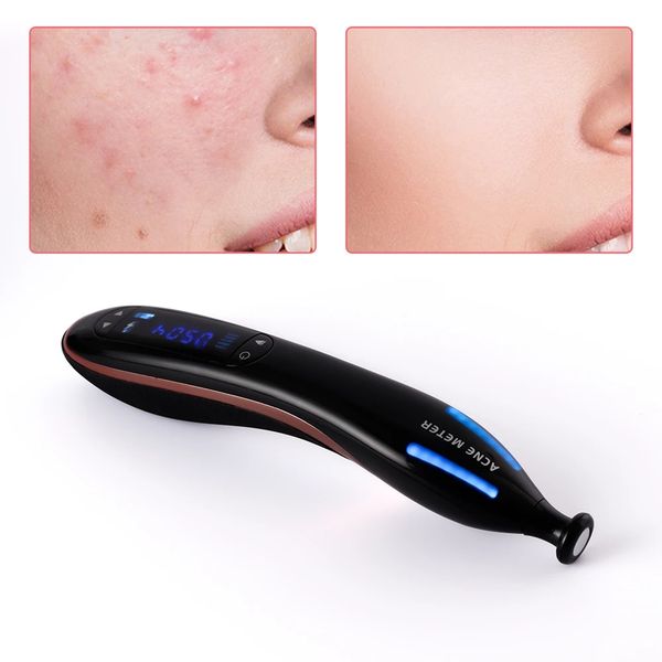 plasma pen other beauty equipment quickly remove acne scar removal wrinkle anti aging treatment machine skin lifting shrink pores ozone ther
plasma pen other beauty equipment quickly remove acne scar removal wrinkle anti aging treatment machine skin lifting shrink pores ozone ther