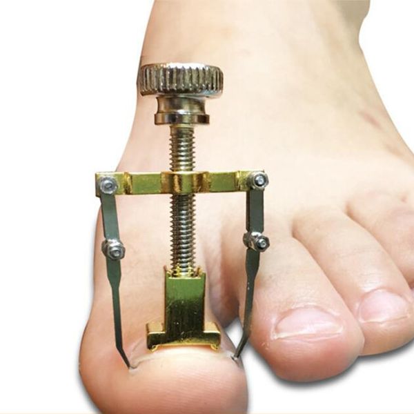 pedicure tool ingrown toe nail corrector paronychia chiropody podiatry foot care repair clipper 220705
pedicure tool ingrown toe nail corrector paronychia chiropody podiatry foot care repair clipper 220705