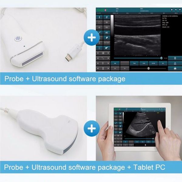 Price u b convex linear probe ultra ound oftware ultra ound canner price ultra ound machine b ultra ound 
Price u b convex linear probe ultra ound oftware ultra ound canner price ultra ound machine b ultra ound