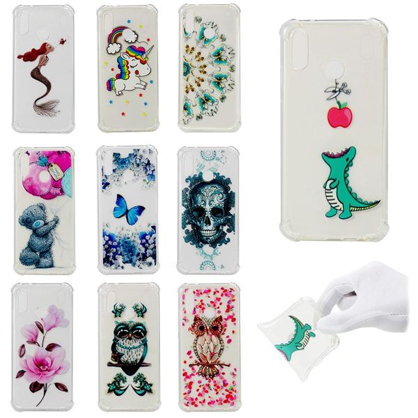 Case For Huawei P8 Lite 2017 P10 P20 Lite Mate 10 Enjoy 7 7S Shockproof Transparent Back Cover Soft TPU
Case For Huawei P8 Lite 2017 P10 P20 Lite Mate 10 Enjoy 7 7S Shockproof Transparent Back Cover Soft TPU