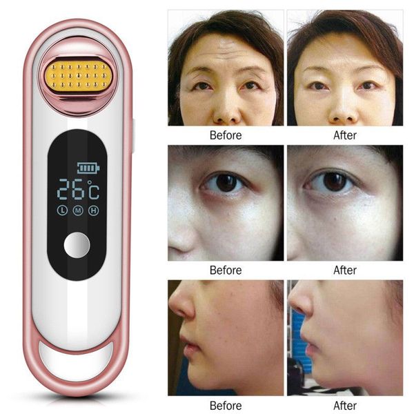 rf radio frequency thermage facial massage machine portable for skin lifting face lift body skin wrinkle removal skin tightening beauty care
rf radio frequency thermage facial massage machine portable for skin lifting face lift body skin wrinkle removal skin tightening beauty care