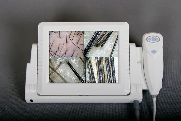 2021 new all in one 2.0 mp high resolution digital ccd hair analysis camera with 8 inch lcd monitor and 4 compare images dhl ship
2021 new all in one 2.0 mp high resolution digital ccd hair analysis camera with 8 inch lcd monitor and 4 compare images dhl ship