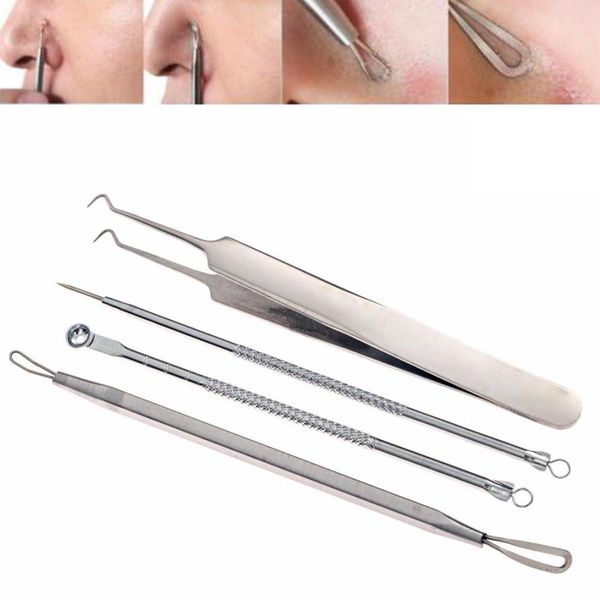 4pcs women stainless steel blackhead facial whitehead remover extractor tool comedone se25 new ing
4pcs women stainless steel blackhead facial whitehead remover extractor tool comedone se25 new ing