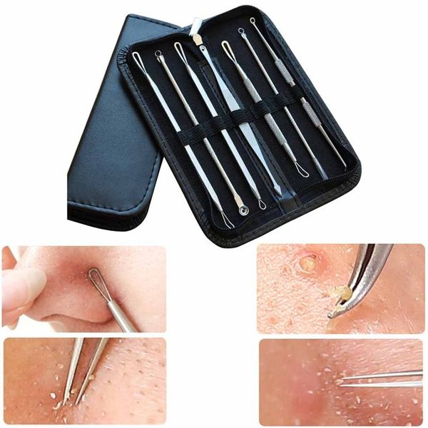 new 7pcs/lot women beauty pimple blemish comedone acne needle extractor remover tools set gift
new 7pcs/lot women beauty pimple blemish comedone acne needle extractor remover tools set gift