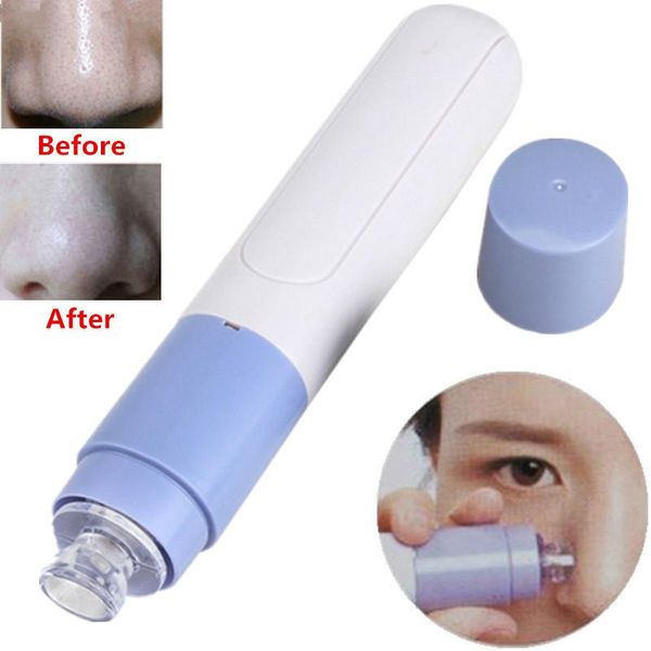 Cleaning kin blackhead remover no e cleaner electric face care tool tighten pore facial dirt uck up acne vacuum pore clean er
Cleaning kin blackhead remover no e cleaner electric face care tool tighten pore facial dirt uck up acne vacuum pore clean er