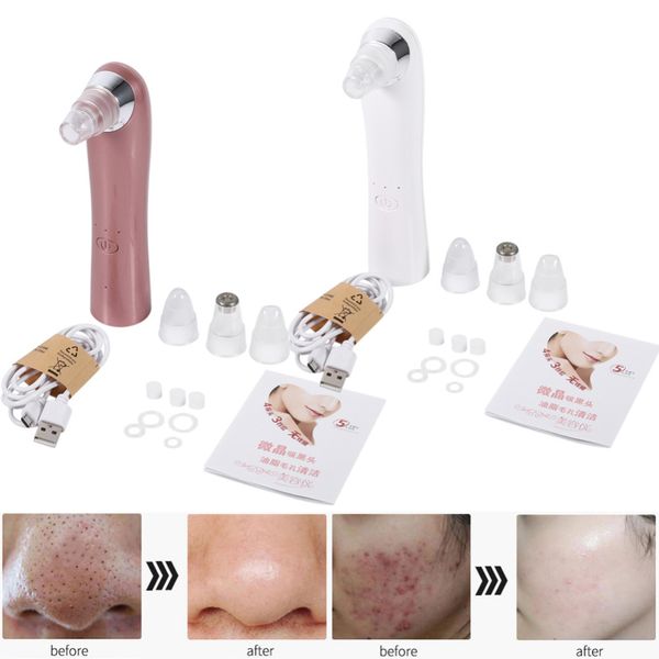 Vacuum Pore Cleaner Blackhead Removal Suction Extractor Cleanser Nose Skin Care Face Spa Acne Remover Electric Beauty Machine