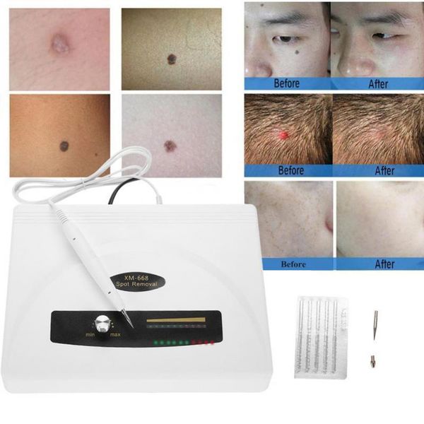 ultrasonic spot removal pen large power freckle tattoo mole removal plasma wart remover pen home spa skin care machine
ultrasonic spot removal pen large power freckle tattoo mole removal plasma wart remover pen home spa skin care machine