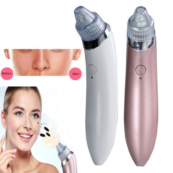 diamond dermabrasion facial pore peeling vacuum suction blackhead cleaner acne remover extractor skin pores cleansing machine
diamond dermabrasion facial pore peeling vacuum suction blackhead cleaner acne remover extractor skin pores cleansing machine