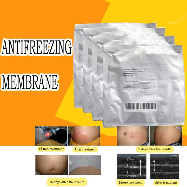 2019 anti freeze membrane 27 30cm 34 42cm antifreezing membrane anti freezing membrane pad for cryo therapy cryolipoly i for home u e
2019 anti freeze membrane 27 30cm 34 42cm antifreezing membrane anti freezing membrane pad for cryo therapy cryolipoly i for home u e