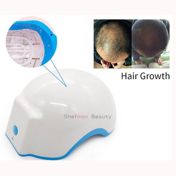 laser helmets hair loss therapy hair regrowth infrared treatment cap anti-hair removal therapy 80 diodes beauty instrument, Black
laser helmets hair loss therapy hair regrowth infrared treatment cap anti-hair removal therapy 80 diodes beauty instrument, Black