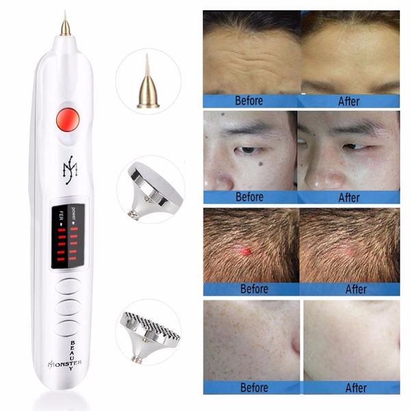 2019 most factory price korea beauty monster plasma lift pen plasma jett for spot and mole removal, Black
2019 most factory price korea beauty monster plasma lift pen plasma jett for spot and mole removal, Black