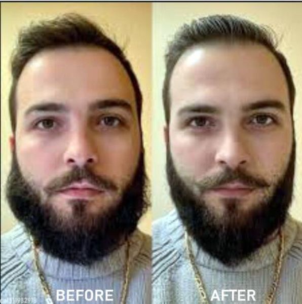 2019 professional beard hair straightener hairdressing comb straightening brush multifunctional curler tool heating comb
2019 professional beard hair straightener hairdressing comb straightening brush multifunctional curler tool heating comb