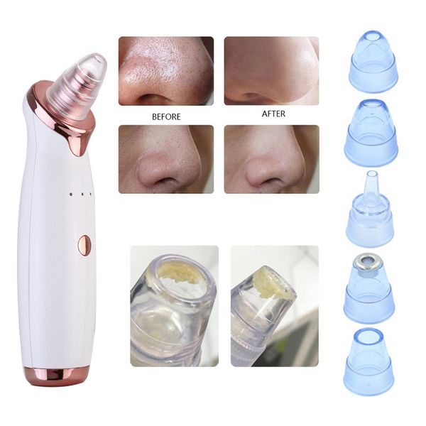 nose blackhead vacuum suction comedones dot pimple remover machine cleaner pore electric blackhead instrument skin care tools
nose blackhead vacuum suction comedones dot pimple remover machine cleaner pore electric blackhead instrument skin care tools