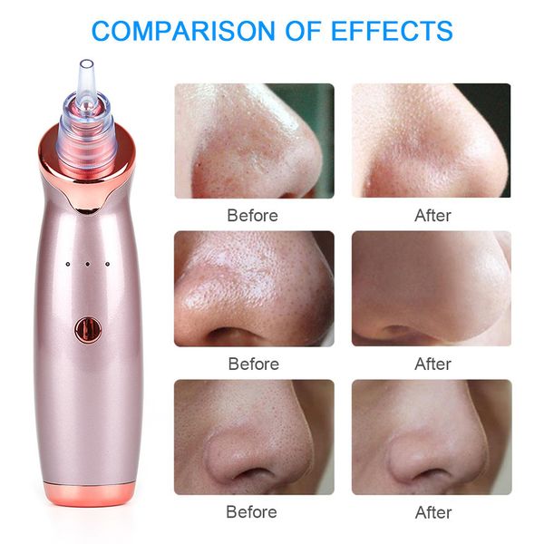 pro electric blackhead vacuum remover skin care beauty machine inhaler spot acne pore cleaner facial cleanser kit
pro electric blackhead vacuum remover skin care beauty machine inhaler spot acne pore cleaner facial cleanser kit