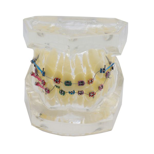 

Стоматологическая стандартная ортодонтическая модель зубов с кронштейнами Буккальные трубки Модель неправильного прикуса Corret Teeth Модель обработки цепи Elastolink
