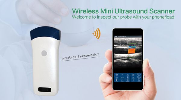 2020 wireless ultrasound convex array probe uprobe with color, cf, pw, pdi funtion color doppler version 128element, 3.5/5mhz
2020 wireless ultrasound convex array probe uprobe with color, cf, pw, pdi funtion color doppler version 128element, 3.5/5mhz