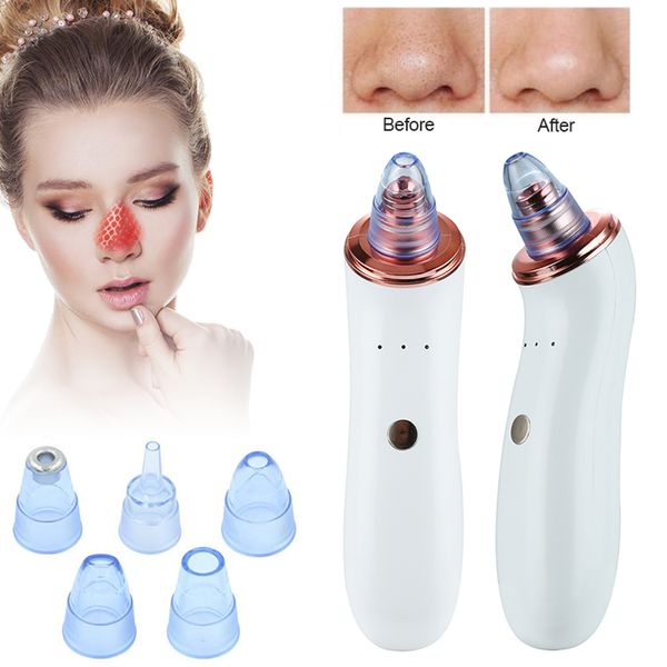pore cleaner blackhead remover vacuum electric nose face deep cleansing skin care machine facial clean black head remover tool
pore cleaner blackhead remover vacuum electric nose face deep cleansing skin care machine facial clean black head remover tool