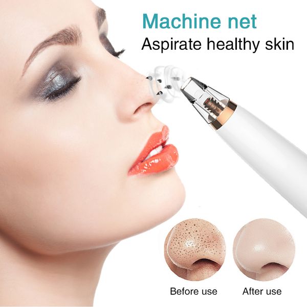 lcd electric blackhead remover for face pore acne black dots vacuum suction remove machine diamond beauty facial skin care tool
lcd electric blackhead remover for face pore acne black dots vacuum suction remove machine diamond beauty facial skin care tool