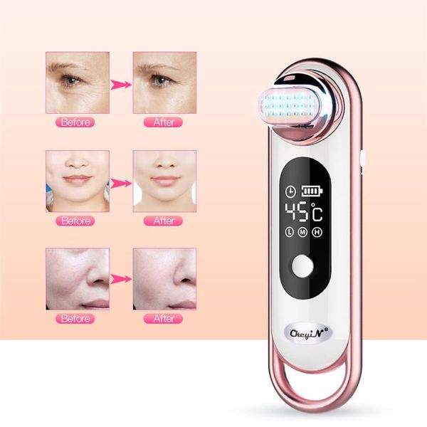 radio frequency rf thermage facial massager ultrasonic chin face lifting wrinkle remove anti-aging beauty massage instrument p46
radio frequency rf thermage facial massager ultrasonic chin face lifting wrinkle remove anti-aging beauty massage instrument p46