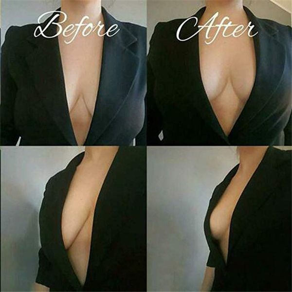 женщины груди лепестки симпатичный кролик бюстгальтер сосков covers push up invisible bra top многоразовые груди клей бюстгальтер bralette i, Black;white
женщины груди лепестки симпатичный кролик бюстгальтер сосков covers push up invisible bra top многоразовые груди клей бюстгальтер bralette i, Black;white
