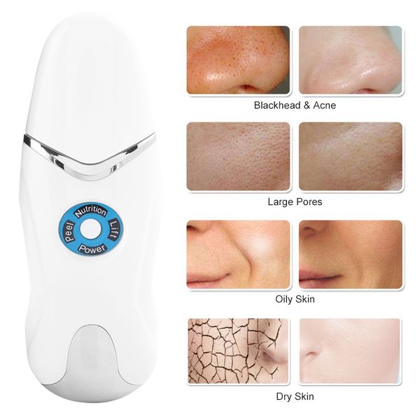 ultrasonic skin scrubber pore cleaning blackhead acne removal pn rejuvenation skin cleaner
ultrasonic skin scrubber pore cleaning blackhead acne removal pn rejuvenation skin cleaner
