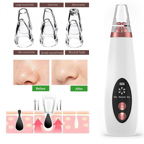 blackhead removal pore vacuum cleaner with 6 vacuum suction heads rechargeable pore cleaner face diamond machine face clean
blackhead removal pore vacuum cleaner with 6 vacuum suction heads rechargeable pore cleaner face diamond machine face clean