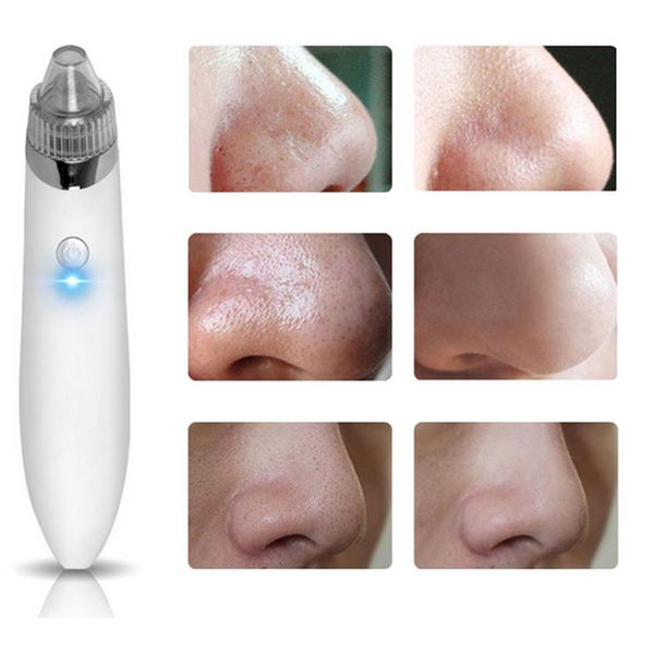 electric pore cleaner acne blackhead remover skin care device pore vacuum extraction usb rechargeable comedo suction facial cleaner
electric pore cleaner acne blackhead remover skin care device pore vacuum extraction usb rechargeable comedo suction facial cleaner