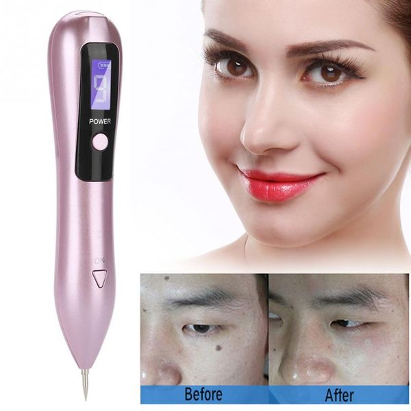 2019 trending products beauty plasma pen for freckle removal pen for dark spot removal
2019 trending products beauty plasma pen for freckle removal pen for dark spot removal